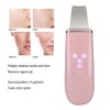 Ultrasonic Skin Scrubber Blackhead Pimple Removal Face Pore Vibration Cleanser