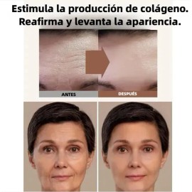 Cyrene Parches Estrella Star Anti Acne Espinillas Granos Fac