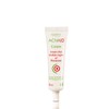 Boderm Acnaid Cream Treats Visible Signs of Rosacea 30ml