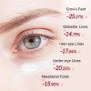 Crema Ojos Retinol Antiarrugas Péptidos Ojeras Todo Tipo Piel Día