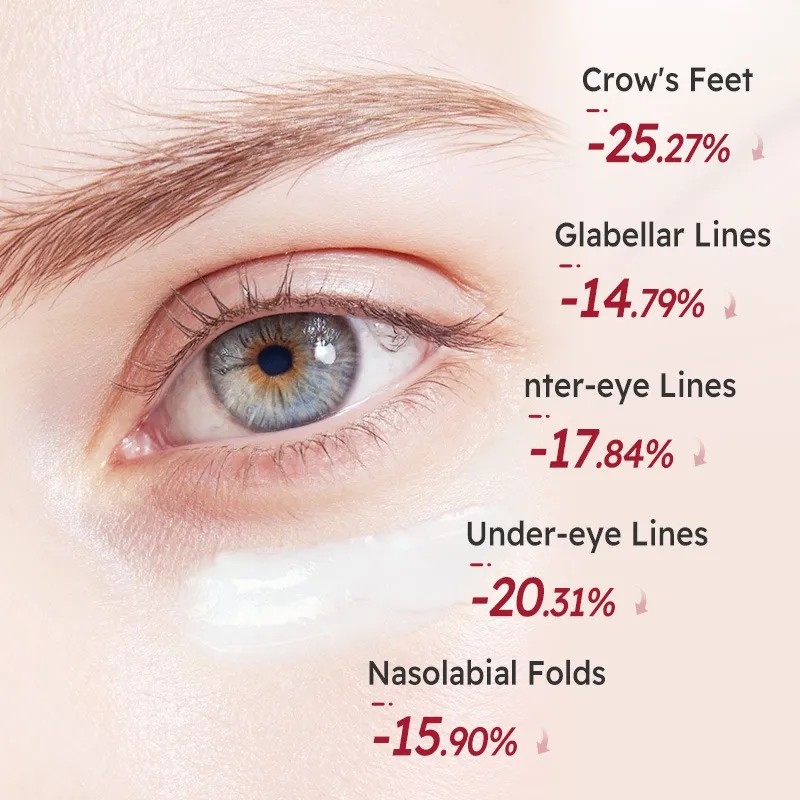 Crema Ojos Retinol Antiarrugas Péptidos Ojeras Todo Tipo Piel Día