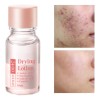 Acne Buster Loción Secante Con Ácido Salicílico 2pcs Todo Tipo