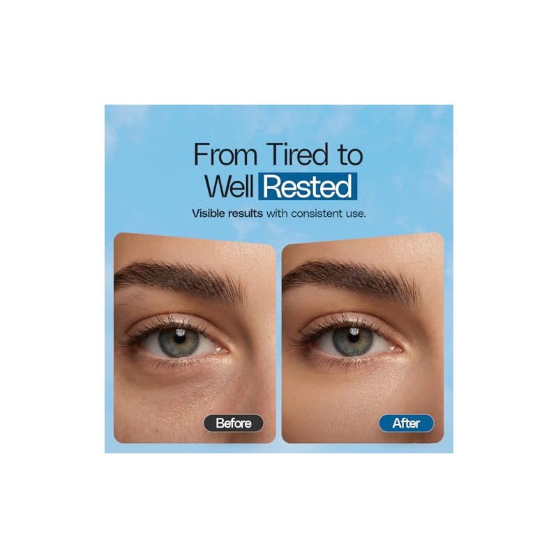 Crema De Cafeína Para El Contorno De Ojos, Antiojeras E
