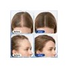 Suero Capilar Para Crecimiento Cabello 3% Romero 1.01 Oz