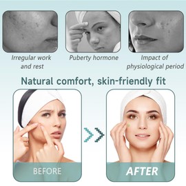 Chihutown 288pcs Hydrocolloid Patches, Multiple Colors Heart Pimple Patch Pimple Patches, Cute Patches in Multiple Sizes for Day and Night