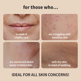 BENTON BENTON Snail Bee High Content Skin (Toner) - Snail Mucin Toner, Snail Mucin Essence Toner, Bee Venom Korean Toner, Korean Skin Care Snail Toner, Face Skin Care Snail Essence, Snail Mucin Moisturizer