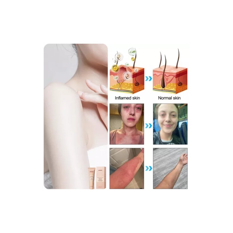 Unbranded Purifying Exfoliating Gel,Quarxery Cleansing Purifying Cream for Face &