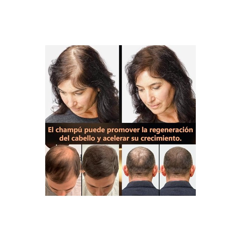Champú Hair ShampooChampú Anticaída de Jengibre