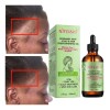 Aceite De Romero Biotina Crecimiento Cabello Cejas Pestañas