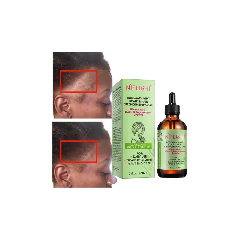 Aceite De Romero Biotina Crecimiento Cabello Cejas Pestañas