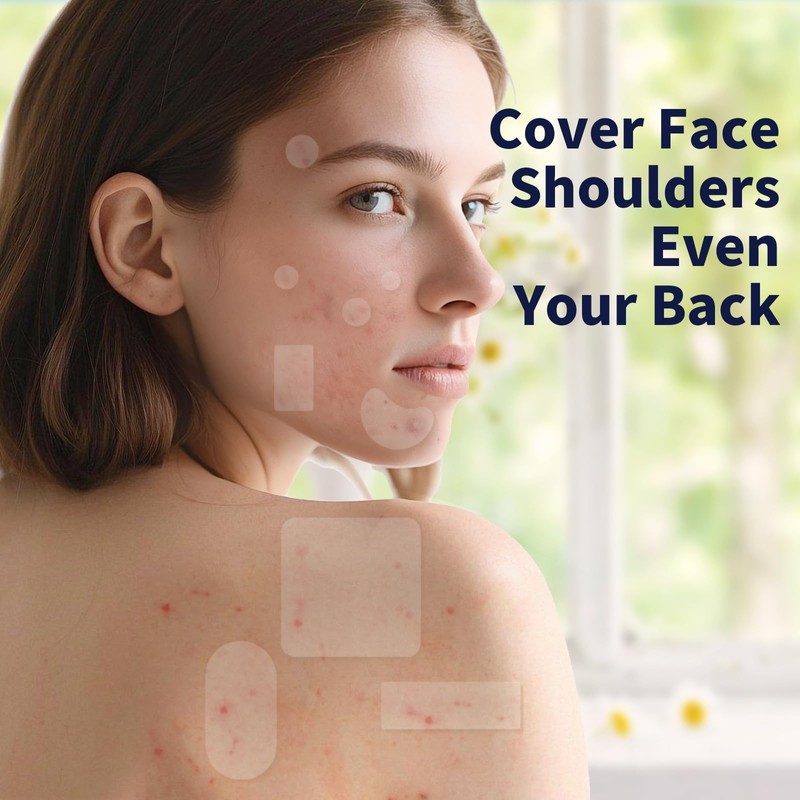 Large Pimple Patches for Face，9 Sizes XL Acne Patches，Big Hydrocolloid