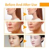Turmeric Firming Whitening Cream, Moisturizer Cream for Face, Remove Wrinkle