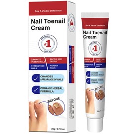 Nail Toenail Cream, Organic Herbal Formula for Thick Discoloured Nails, 20g