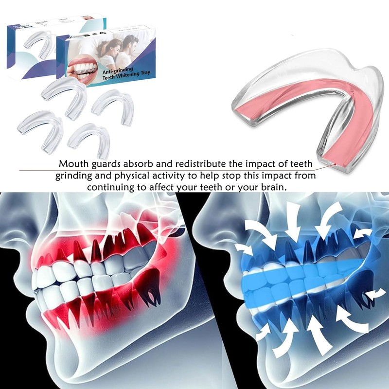 Pack of 4 Grinding Splints for Night, Mouth Guard for
