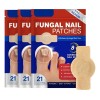 ~ Parches Para Uñas Fc Fungal, 63 Unidades/caja De Parche
