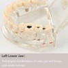 2PCS Transparent Disease Teeth Model, Dental Implant Teeth Model, Dental