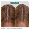 Biolage Scalp Sync Purifying Scalp Concentrate 200ml