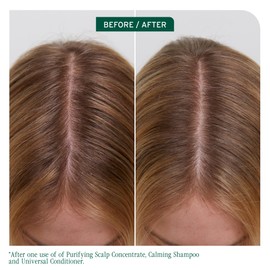 Biolage Scalp Sync Purifying Scalp Concentrate 200ml