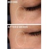 StriVectin FRESH StriVectin-C Firming Eye Cream with Vitamin C &