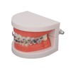Dental Typodont Teeth Model with Orthodontic Metal Bracket for Dentist