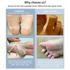 Dead skin exfoliating foot mask Cuticle removal Foot peeling Moisturizing