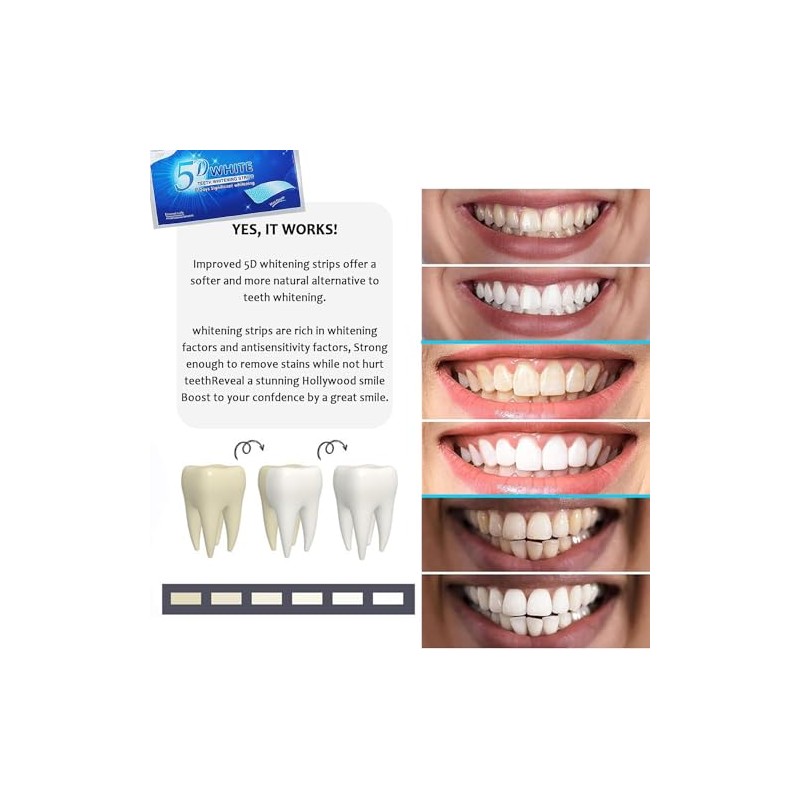 Tiras Blanqueadoras Dientes Sensibles Piezas Kit Completo Fácil Usar Resultados