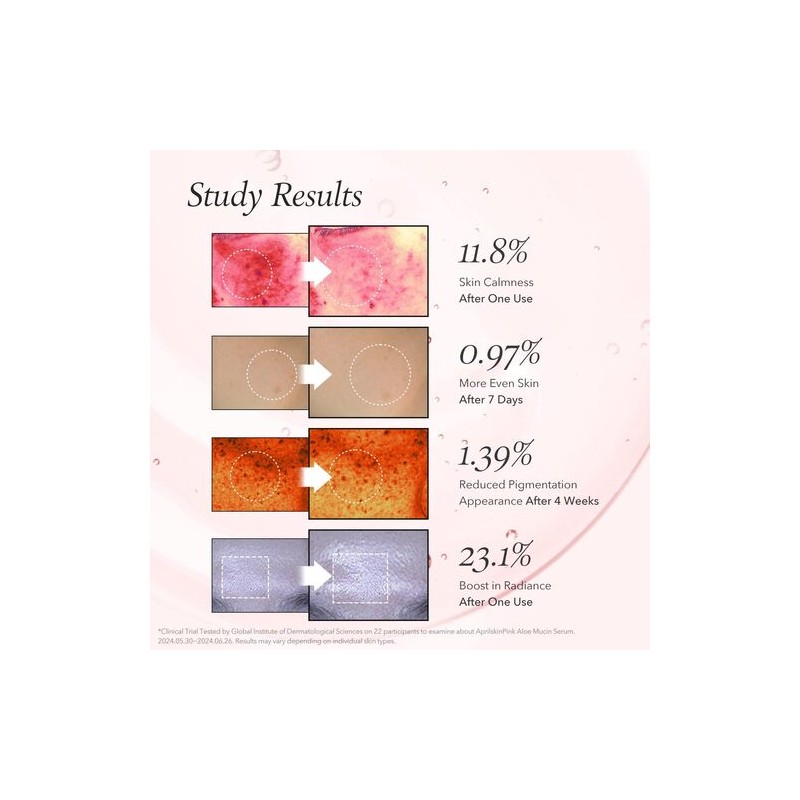 APRILSKIN [APRILSKIN]Pink Aloe Mucin Serum 30ml