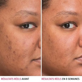 It Cosmetics Bye bye Dark Spots, Serum, Suero 4% Niacinamida Reduce las Manchas Oscuras y Mejora la Textura de la Piel en 8 Semanas, con 1% de Vitamina C Etílica, Todo Tipo de Piel, 30 ml