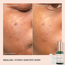 Suero para manchas oscuras Biossance Squalane + Vitamin C. Suero ligero y potente con 10% de vitamina C para iluminar la piel, atenuar las manchas osc