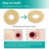 Ostomy Barrier Rings - Outer Diameter 2" (50mm) 4mm Thickness,Moldable