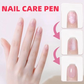 1 PCS Nail Care Pen,Nail Care Pen & Serum,Nail P-en,Nourishing Cuticle Oil & Growth Treatment for Nails & Feet,Nail Treatment for Toenails,Cuti-cle O-il P-en,Na-il Growth Oi-l,Nai-l Repair Pe-n