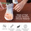 Welnove Pack of 10 Bunion Correction, Toe Separators with 2