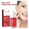 Suero Corrector De Manchas Oscuras Con Niacinamida
