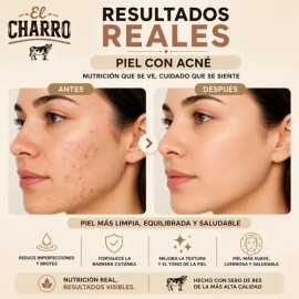 Kit 3 Mantecas De Sebo Bovino El Charro Crema Hidratante Facial Y Corporal Crema Para Manchas Piel Seca Dermatitis Hidratación Profunda