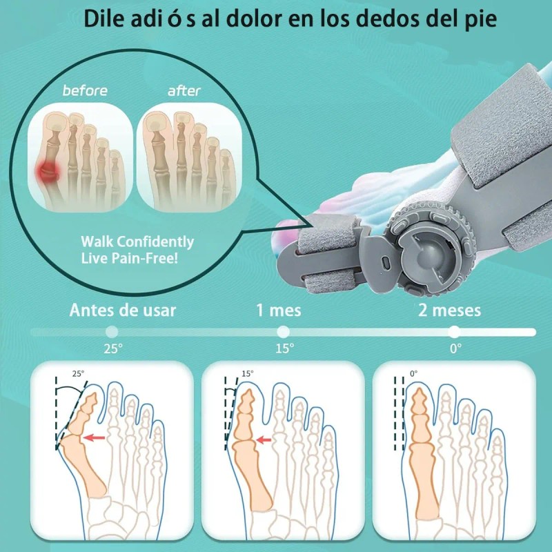 5 Pzas Corrector Y Separadores De Juanete Ajustable Gris Universal