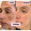 Generic Tonico Despigmentante LB *Elimina pecas, barros, paños, melasma*