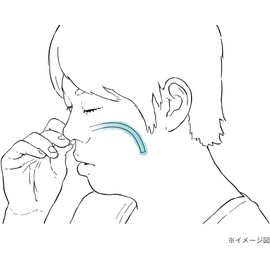 いびきを防ぐ一般医療機器：ナステント クラシック (右120mm Soft)
