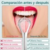 Raspador de Lengua de Acero Inoxidable 6 Piezas para Aliento
