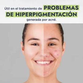 Neem Aceite Puro Orgnico Prensado en Fro Capilar y Facial antiinflamatorio anti-acne, Hebbe Cosmetics  Ludika 250ml                                   