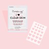 The Crème Shop Heart Shape Clear Skin Hydrocolloid Dark Spot