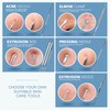 Teenitor 7 in 1 Pimple Popper Tool Kit - Blackhead
