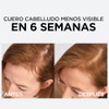 LOreal Paris Serum Capilar Caída Resist con Aminexil Elvive 102ml.