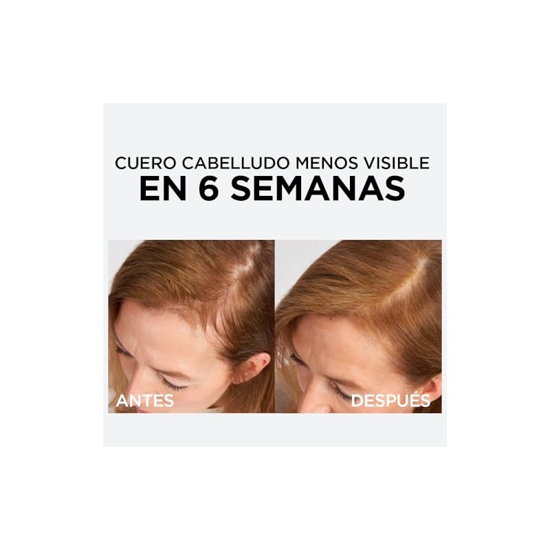 LOreal Paris Serum Capilar Caída Resist con Aminexil Elvive 102ml.
