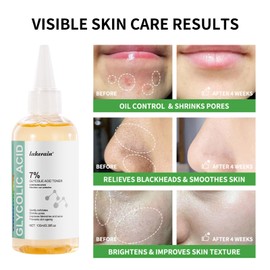 Glycolic Acid 7% Exfoliating Toner, Glycolic Acid Toning Solution for Diminished Dullness & Fine Lines, Reduces Skin Blemishes, Rejuvenate Your Skin