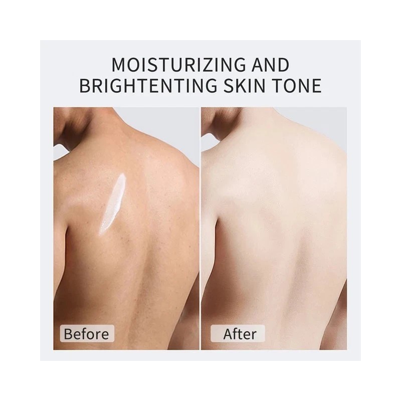 Kojic Sen Skin Lighthening Body Lotion Darkspots Brightens, 16oz [USA