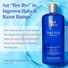 Solucin Para El Cuidado De La Piel Skincare Tend 473