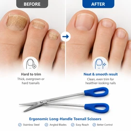 Long Handle Toenail Clippers for Thick Nails – Stainless Steel Pedicure Scissors with Easy Grip for Seniors