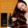 Men and Women Hair Growth Serum,Hair Serum for Hair Growth,Hair