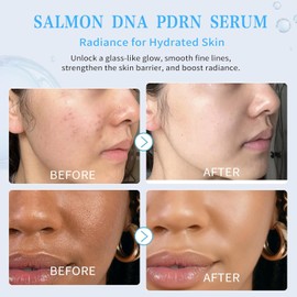 Salmon DNA PDRN Peptide Serum | 99% Salmon DNA PDRN Intensive Ampoule | Peptide, Collagen, 6 Hyaluronic Acid, Niacinamide | Anti-Aging, Moisturizing, Uneven Skin Tone, Korean Skincare 0.05 fl oz x 30e