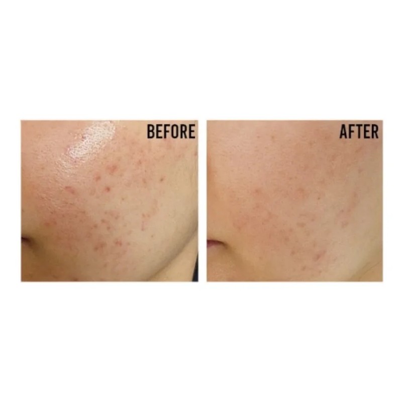 Beauty Joseon Relief Sun Rice Probiotics 50ml Kbty
